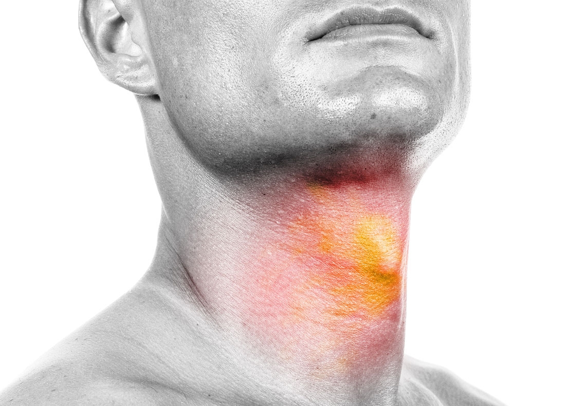 Oral, Head and Neck Cancer Awareness Week American Academy of